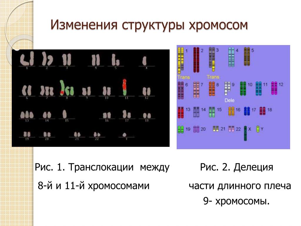 Изменение формы хромосом. Кариотип с изменением структуры хромосом. Изменение строения хромосом. Изменения структурной организации хромосом. Измененная структура хромосом.