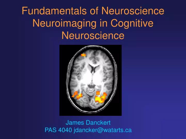 fundamentals of neuroscience neuroimaging in cognitive neuroscience n.