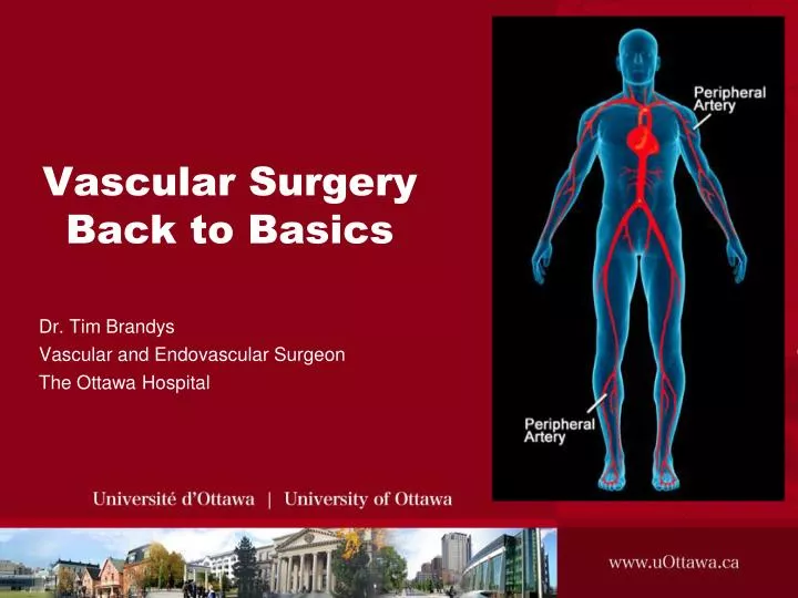 PPT Vascular Surgery Back to Basics PowerPoint Presentation, free download ID5781851