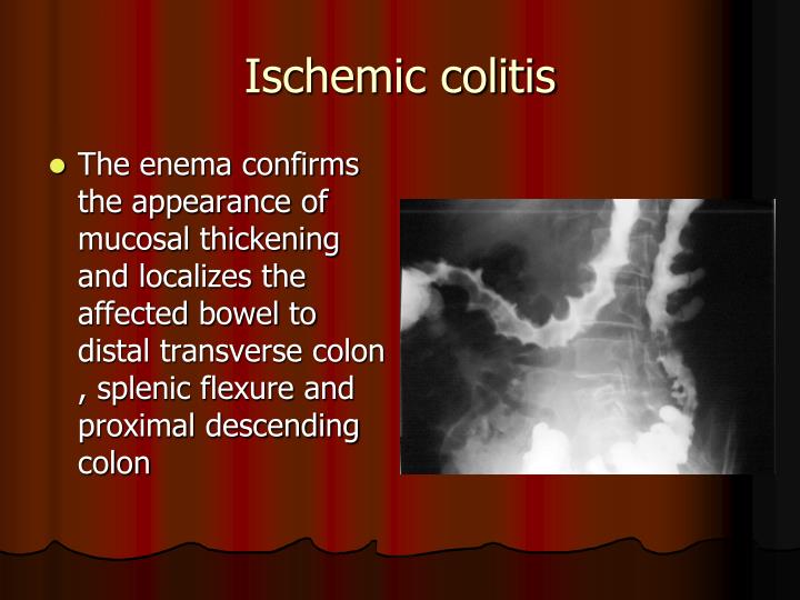 PPT Bowel Ischemia PowerPoint Presentation ID5787723