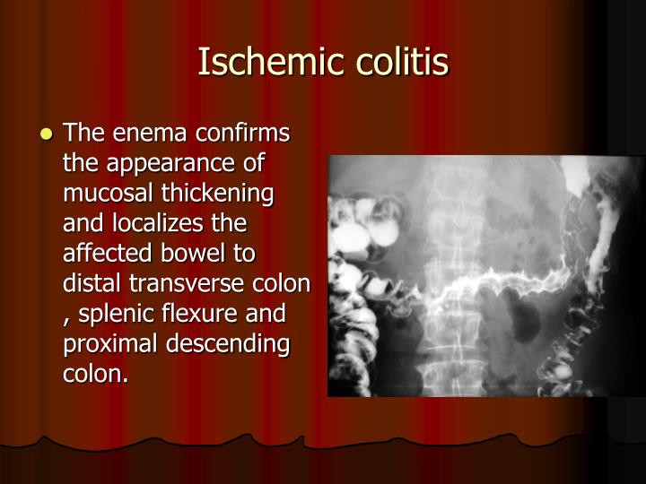 PPT - Bowel Ischemia PowerPoint Presentation - ID:5787723