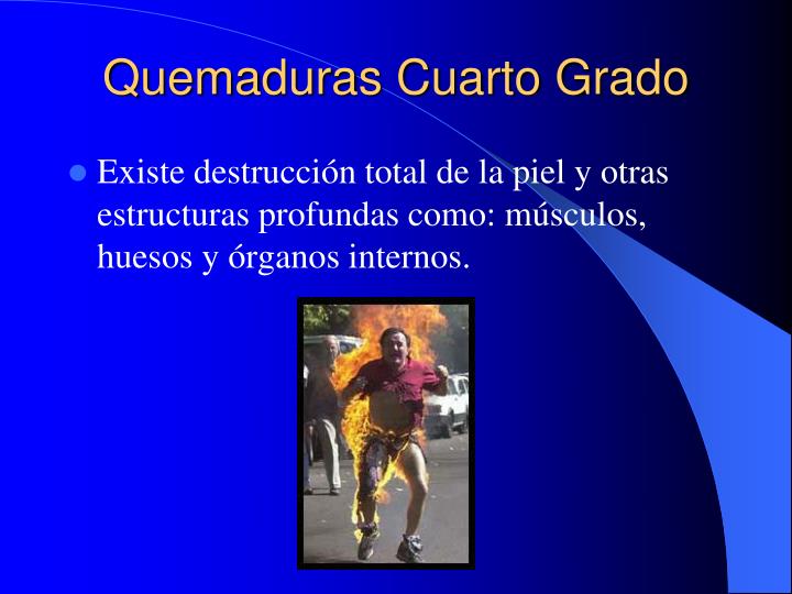 PPT - La Piel PowerPoint Presentation - ID:5790394 PPT - La Piel PowerPoint Presentation - ID:5790394