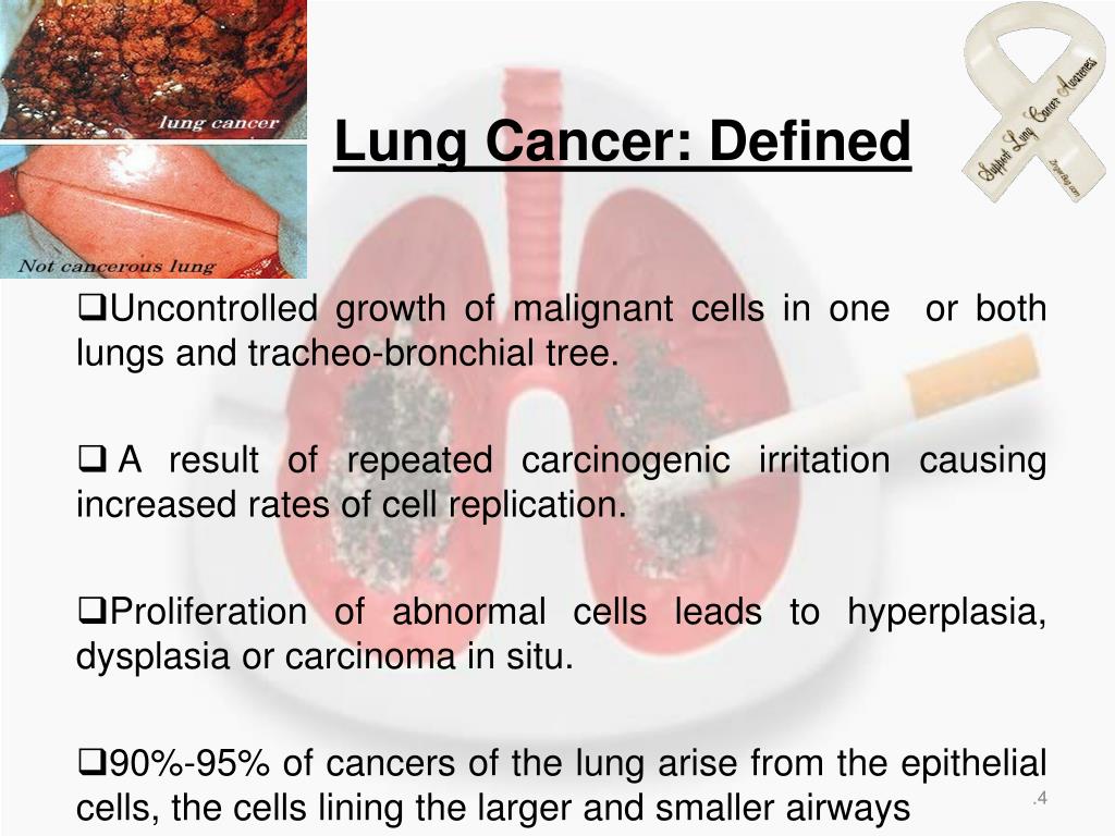 what is the presentation of lung cancer