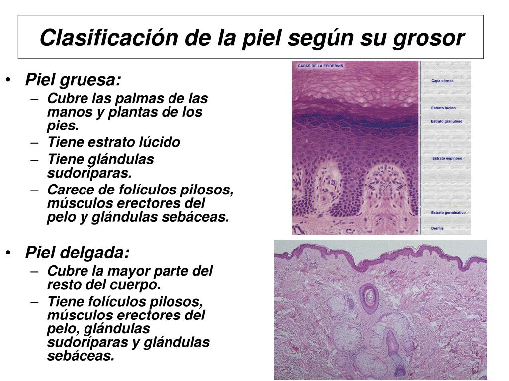 juguete Enlace apenas PPT - HISTOLOGÍA DE LA PIEL PowerPoint Presentation, free download -  ID:5792739