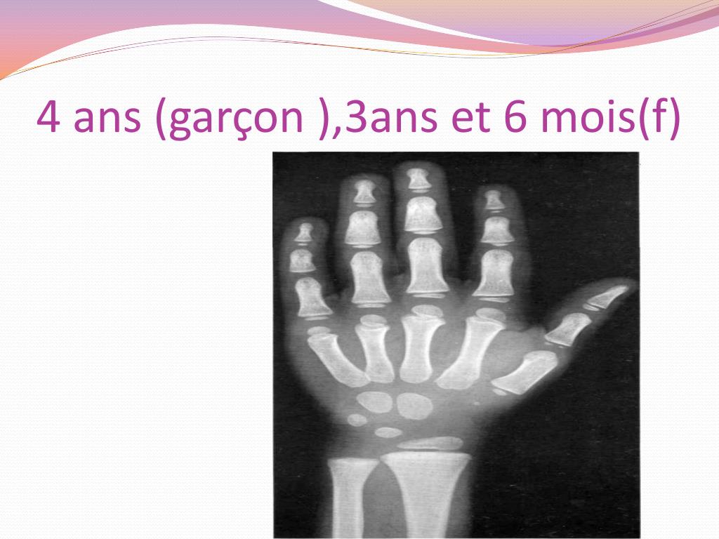 PPT - L' age osseux PowerPoint Presentation, free download - ID:5794631