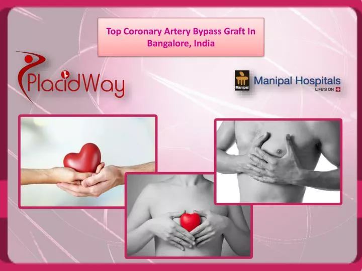 top coronary artery bypass graft in bangalore india n.