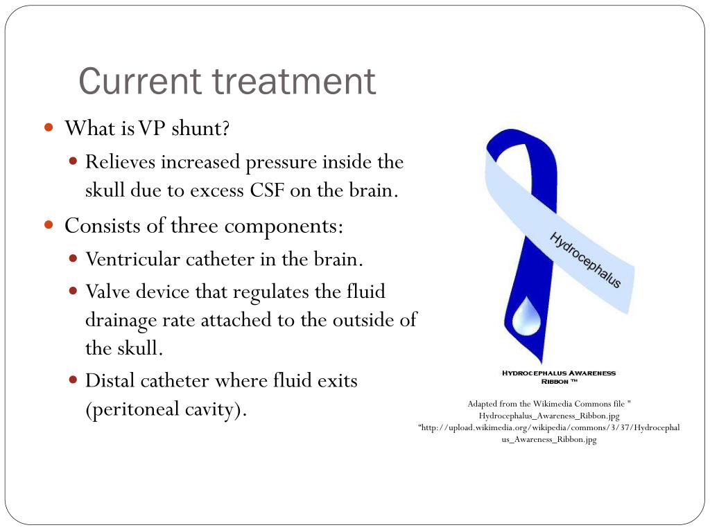 Cerebral shunt - Wikipedia