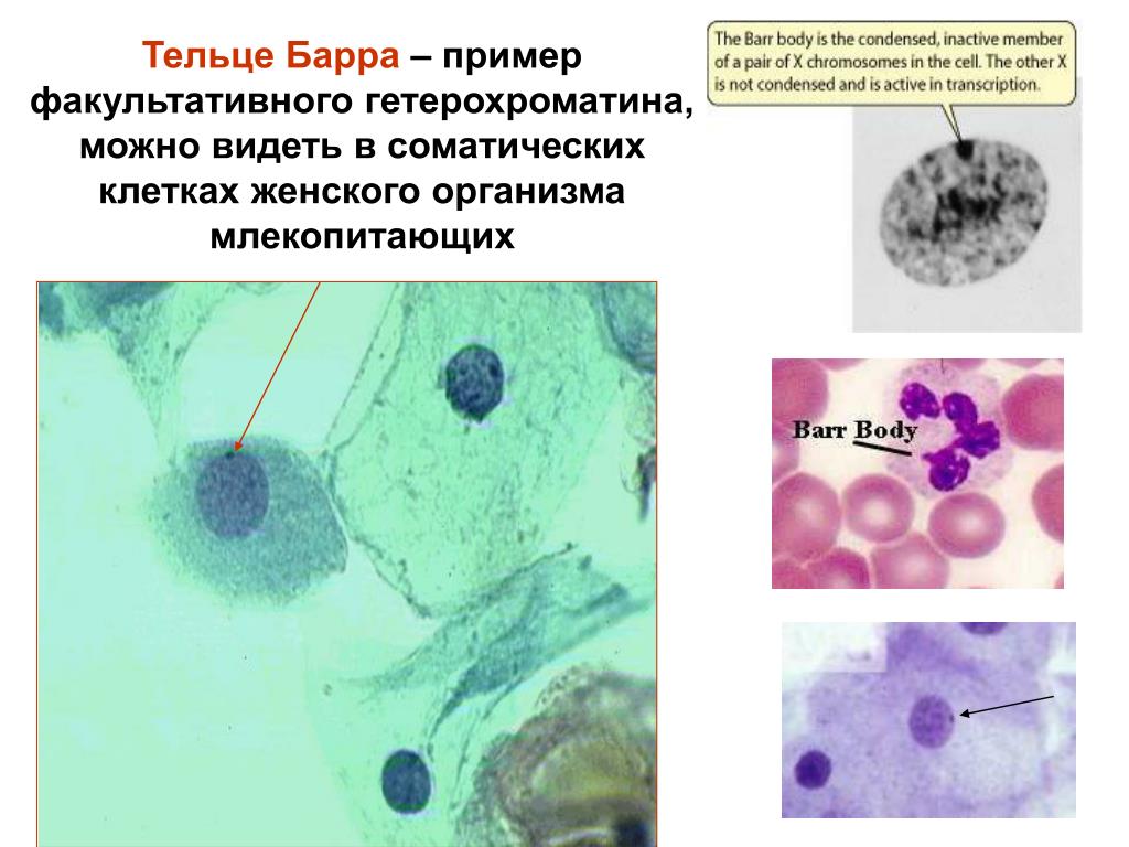 Соматическая клетка здоровой женщины