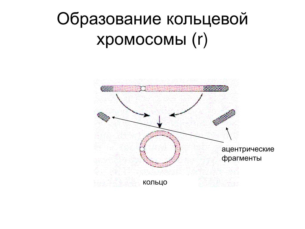 Имеется кольцевая хромосома. Кольцевая хромосома. Возникновение кольцевых хромосом. Ацентрическая Кольцевая хромосома. Образование кольцевой хромосомы.