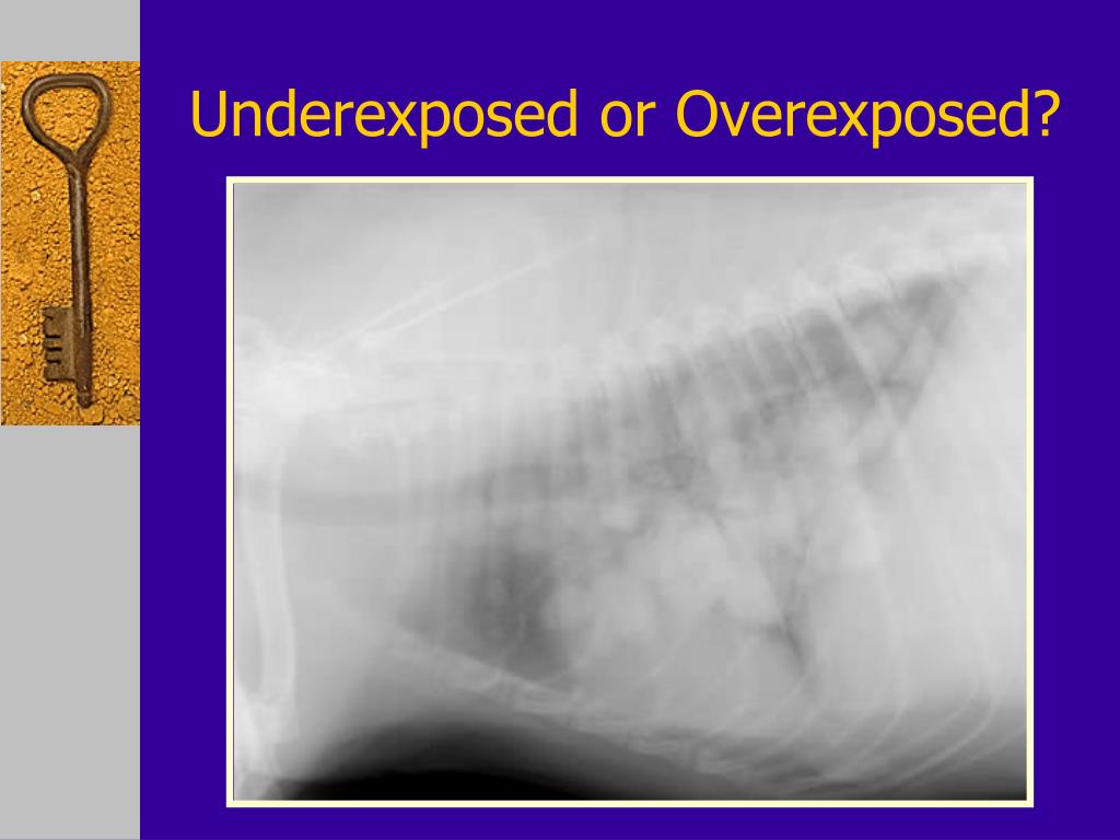 overexposed x ray overexposed x ray