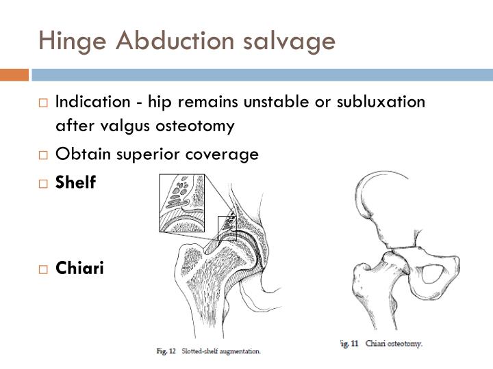 PPT LegG Calve Perthes Disease PowerPoint Presentation ID5839224
