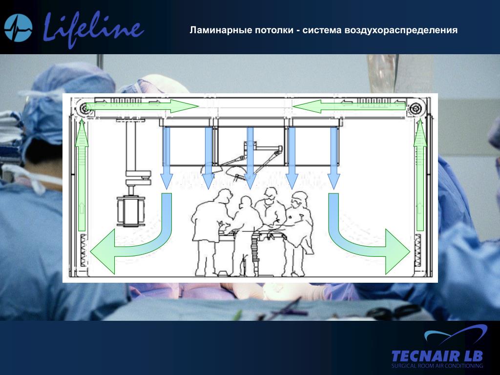 Ламинарный поток воздуха. Ламинарные потолки для операционных. Ламинарный поток воздуха в операционных. Система воздухораспределения. Ламинарный потолок для операционной.