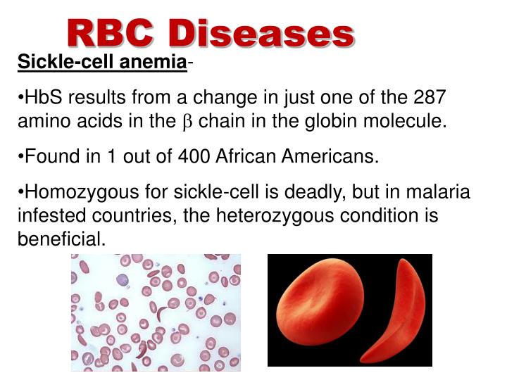 sickle cell anemia a red blood cell disorder Scientists have designed what appears to be a powerful gene therapy strategy that can treat both beta-thalassemia disease and sickle cell anemia they have also developed a test to predict patient response before treatment. sickle cell anemia a red blood cell disorder Scientists have designed what appears to be a powerful gene therapy strategy that can treat both beta-thalassemia disease and sickle cell anemia they have also developed a test to predict patient response before treatment.