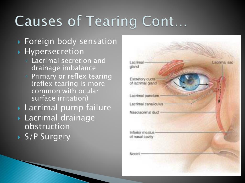 PPT The Tear Evaluation PowerPoint Presentation, free download ID