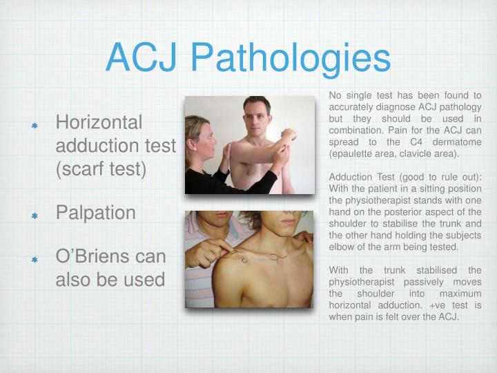 PPT - Orthopaedic special tests for the shoulder PowerPoint ...