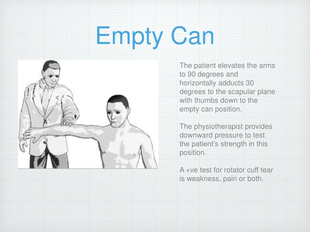 PPT - Orthopaedic special tests for the shoulder PowerPoint ...