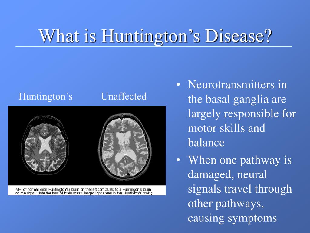 PPT - Anticipation and Huntington’s Disease PowerPoint Presentation