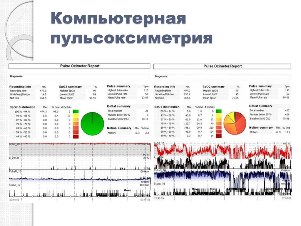 Комплекс суточного мониторирования ад валента Комплекс суточного мониторирования ад валента