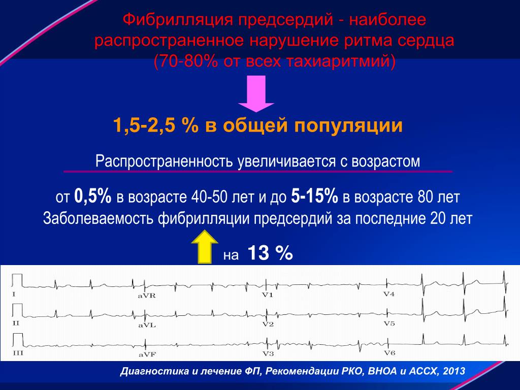 Пароксизм фибрилляции предсердий что это. Хроническая форма фибрилляции предсердий. Фибрилляция предсердий на ЭКГ нормоформа. Ритмированная форма фибрилляции предсердий. Фибрилляция предсердий норма форма.