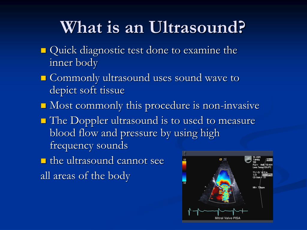 Ppt Ultrasound Powerpoint Presentation Free Download Id5961545
