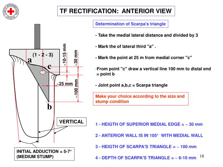 PPT - MEASUREMENTS, CASTING & RECTIFICATION FOR TRANS-FEMORAL (TF ...