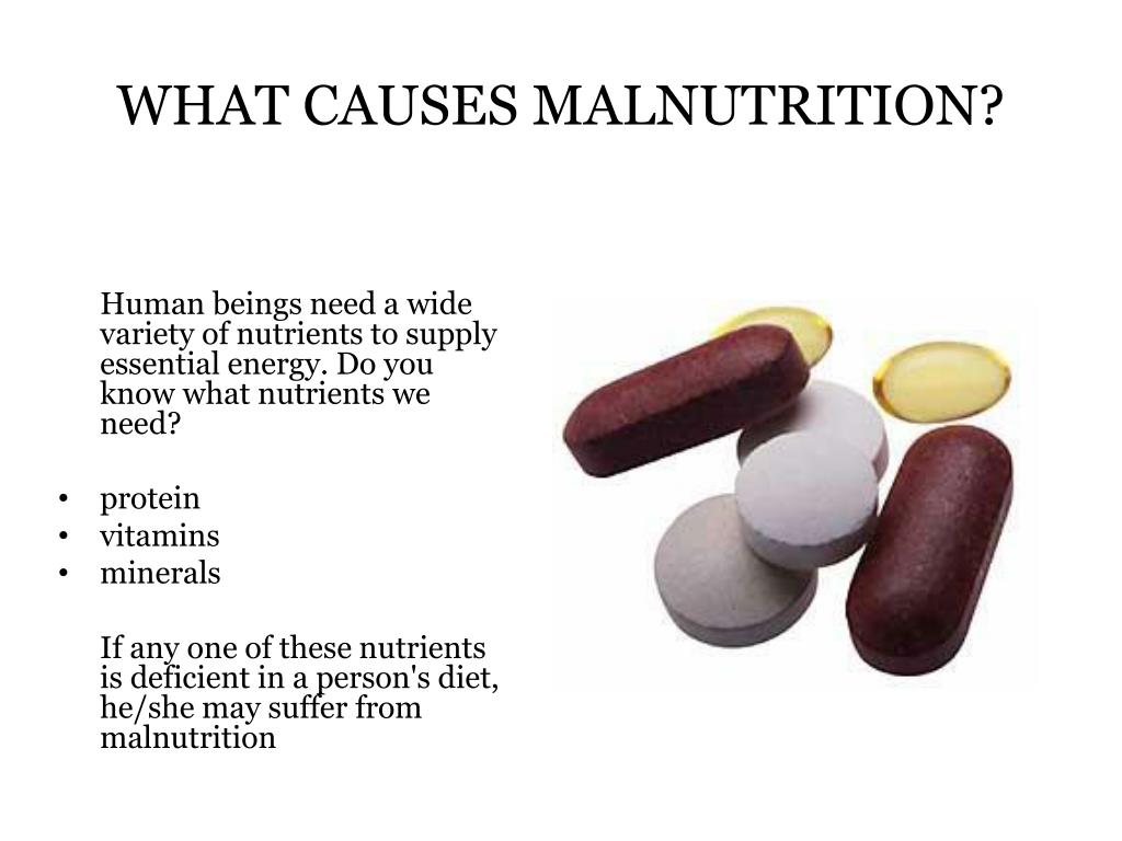 ppt-causes-of-malnutrition-powerpoint-presentation-free-download