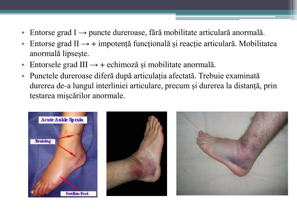 cum se tratează artroza pe picior inflamația unguentului articulației umărului