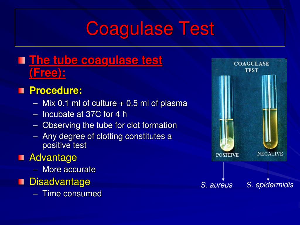 How to identify Staphylococcus aureus using the Coagulase Test - Slide and  Tube Method - 4K 