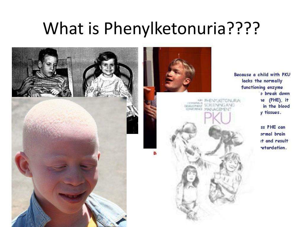 Gambar 4: Phenylketonuria PowerPoint Presentation