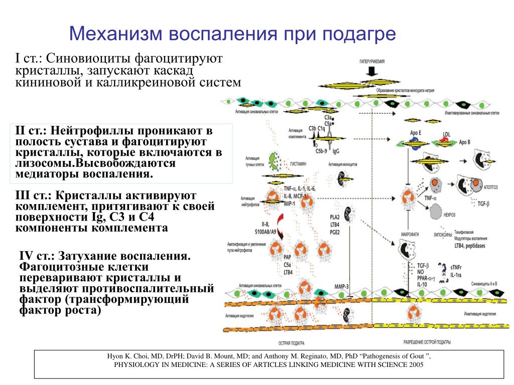 Механизм действия воспаления. Патогенез подагры схема. Механизм развития подагры схема. Механизм воспаления при подагре. Подагра механизм возникновения.