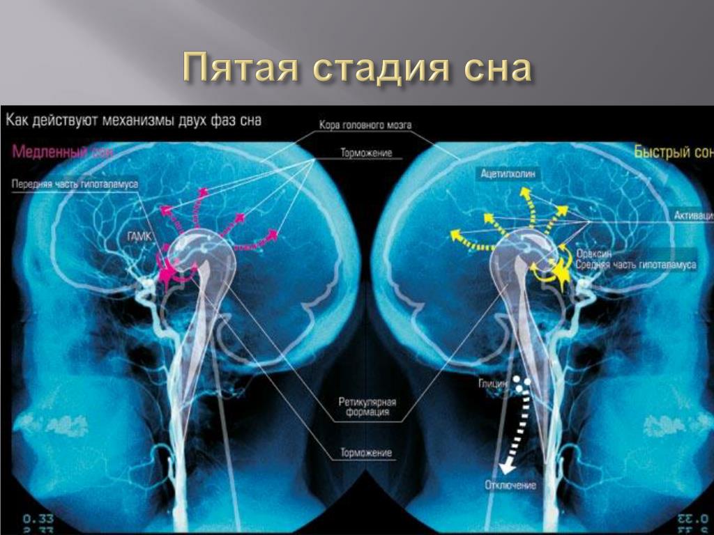 Работа мозга во время сна. Механизмы быстрого и медленного сна. Сон и мозг человека. Сон структуры мозга. Нейромедиаторы сна.