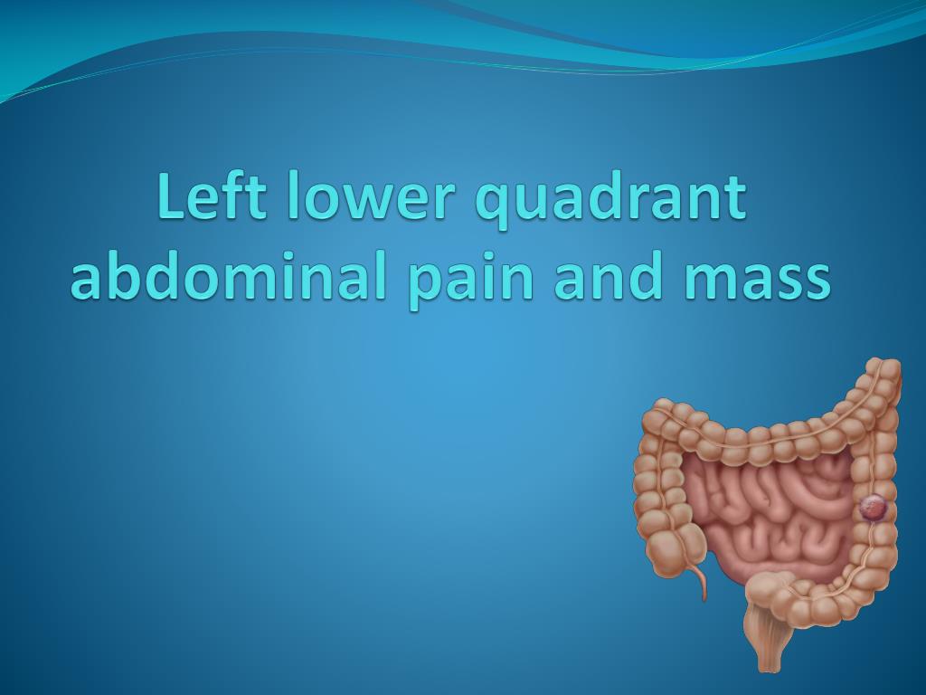 PPT - Left lower quadrant abdominal pain and mass PowerPoint