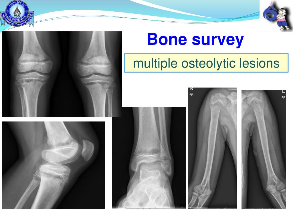 PPT - Interhospital Pediatric Conference PowerPoint Presentation, free ...