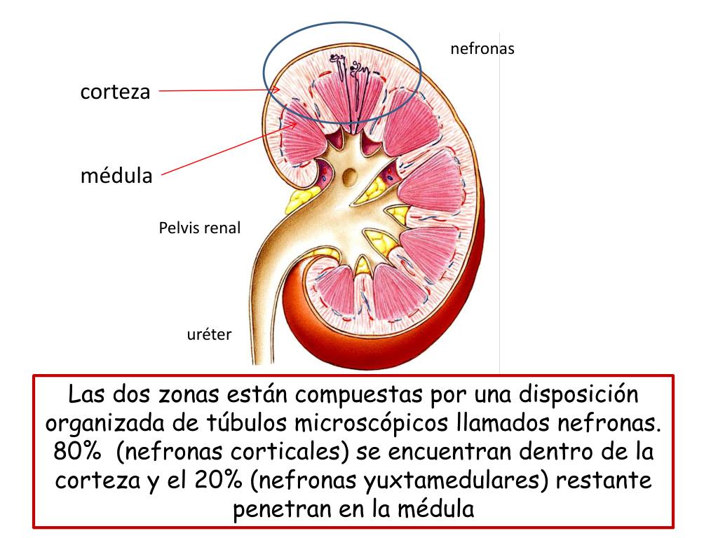 Hasta que tamaño se puede expulsar un cálculo renal