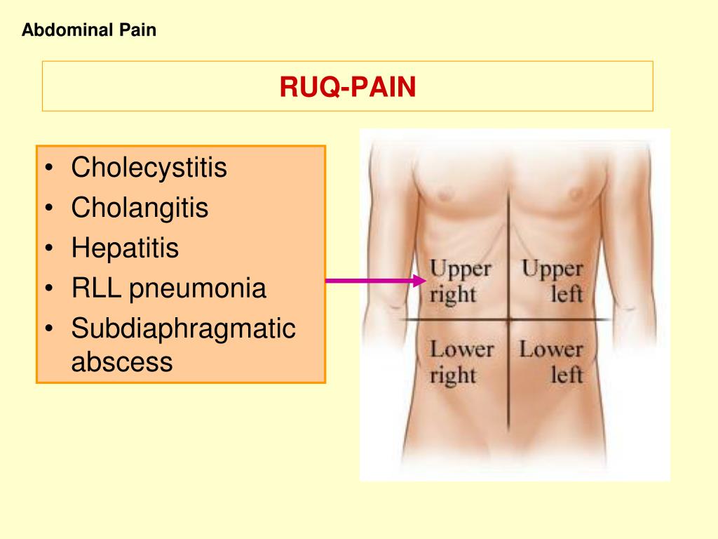 PPT Approach To Abdominal Pain PowerPoint Presentation, free download PPT Approach To Abdominal Pain PowerPoint Presentation, free download
