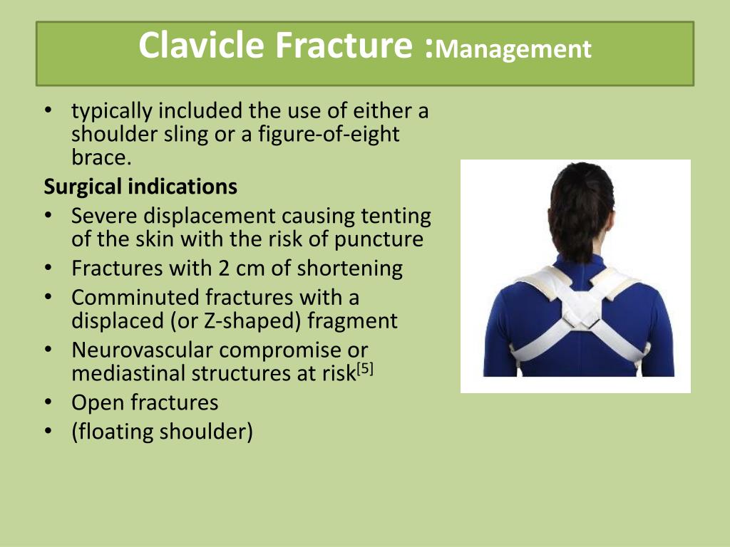 PPT - Common upper limb fractures PowerPoint Presentation, free ...