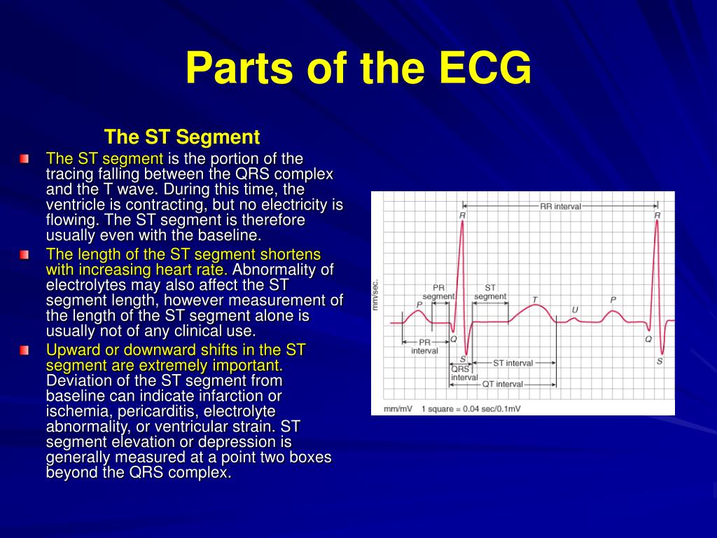 PPT ECG Basics PowerPoint Presentation free download ID:6029627 PPT ECG Basics PowerPoint Presentation free download ID:6029627