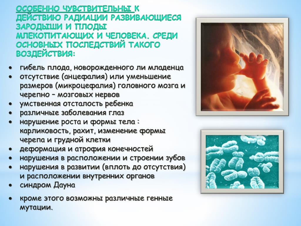 Минусы радиации. Влияние ионизирующего излучения на плод. Влияния радиации на эмбрионы человека. Влияние радиации на эмбрион. Действие ионизирующего излучения на плод и эмбрион.