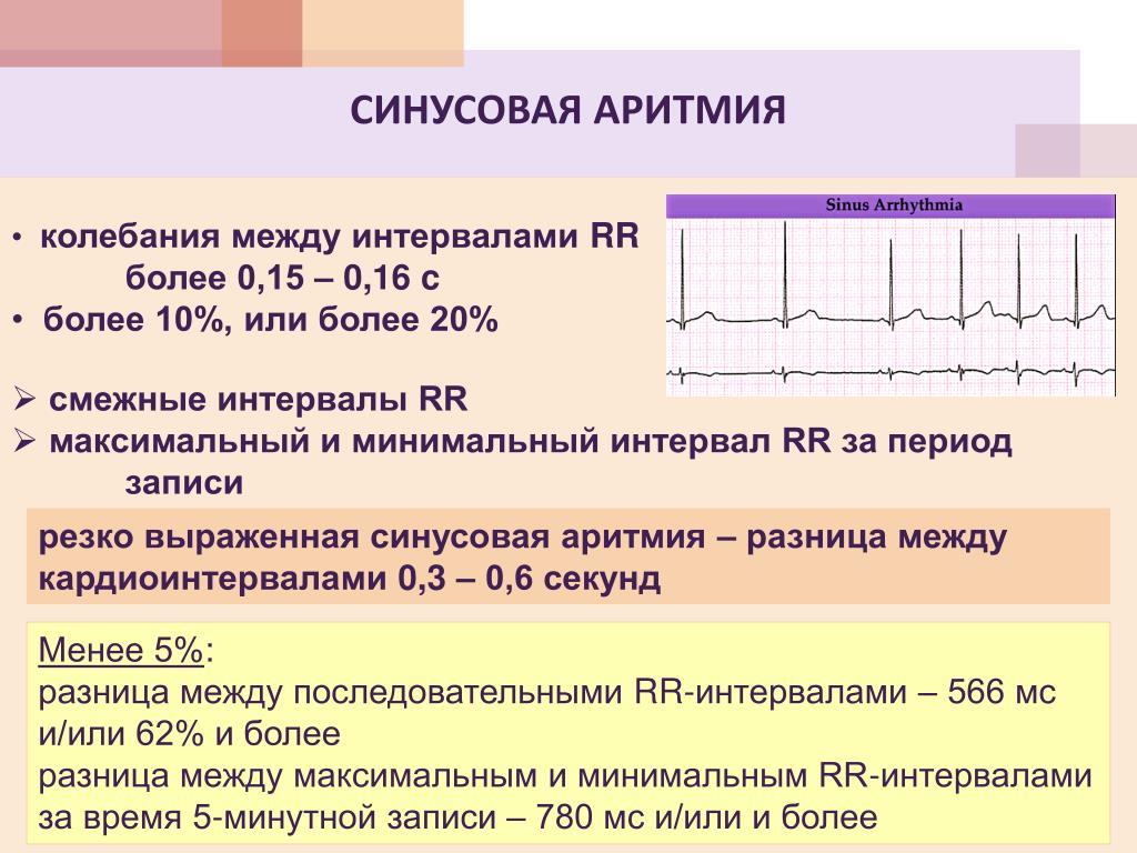 Что значит синусовый ритм сердца на экг. ЭКГ С синусовой аритмией сердца. Синусовая аритмия на ЭКГ расшифровка. Кардиограмма сердца расшифровка синусовый ритм норма. Синусовый ритм сердца на ЭКГ У взрослого норма.