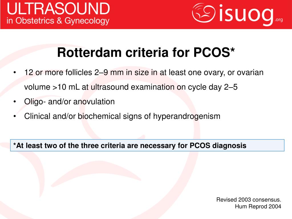 Rotterdam Consensus Criteria