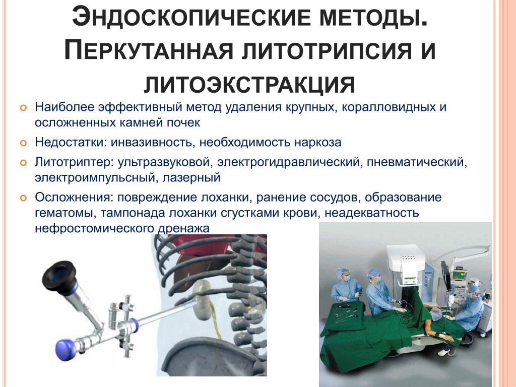 Где Можно Купить Литературу Про Перкутанную Нефролитотрипсию