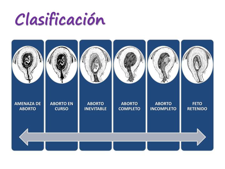 Resultado de imagen para clasificación del aborto