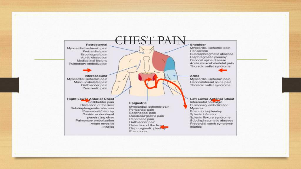 Pathophysiology Of Chest Pain pathophysiology-of-chest-pain