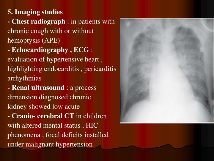 PPT - Acute glomerulonephritis PowerPoint Presentation - ID:6042020