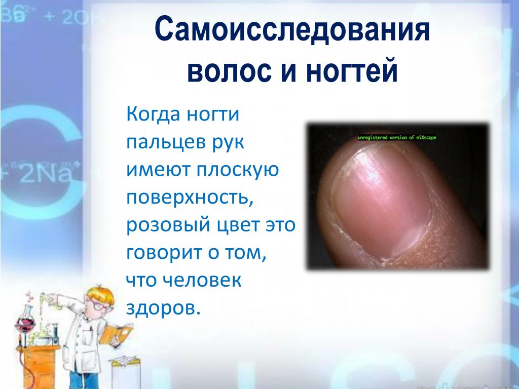 Определение болезни по ногтям. Состояние здоровья по ногтям. Заболевания по состоянию ногтей. Определение здоровья по ногтям. Диагностика по ногтям.