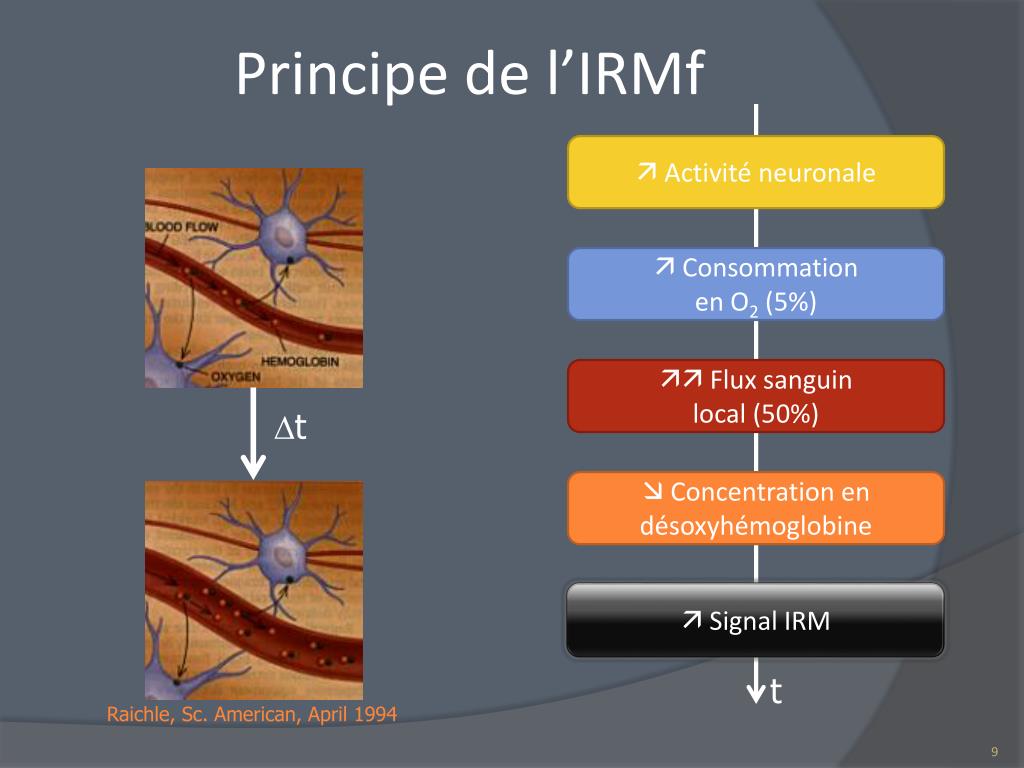 PPT - Cartographie fonctionnelle du cerveau épileptique lors des