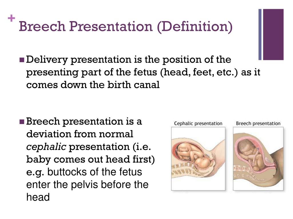 meaning of breech presentation in hindi