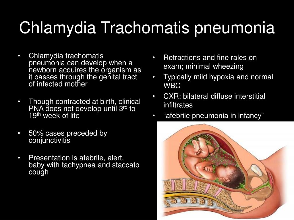 Хламидия трахоматис положительно