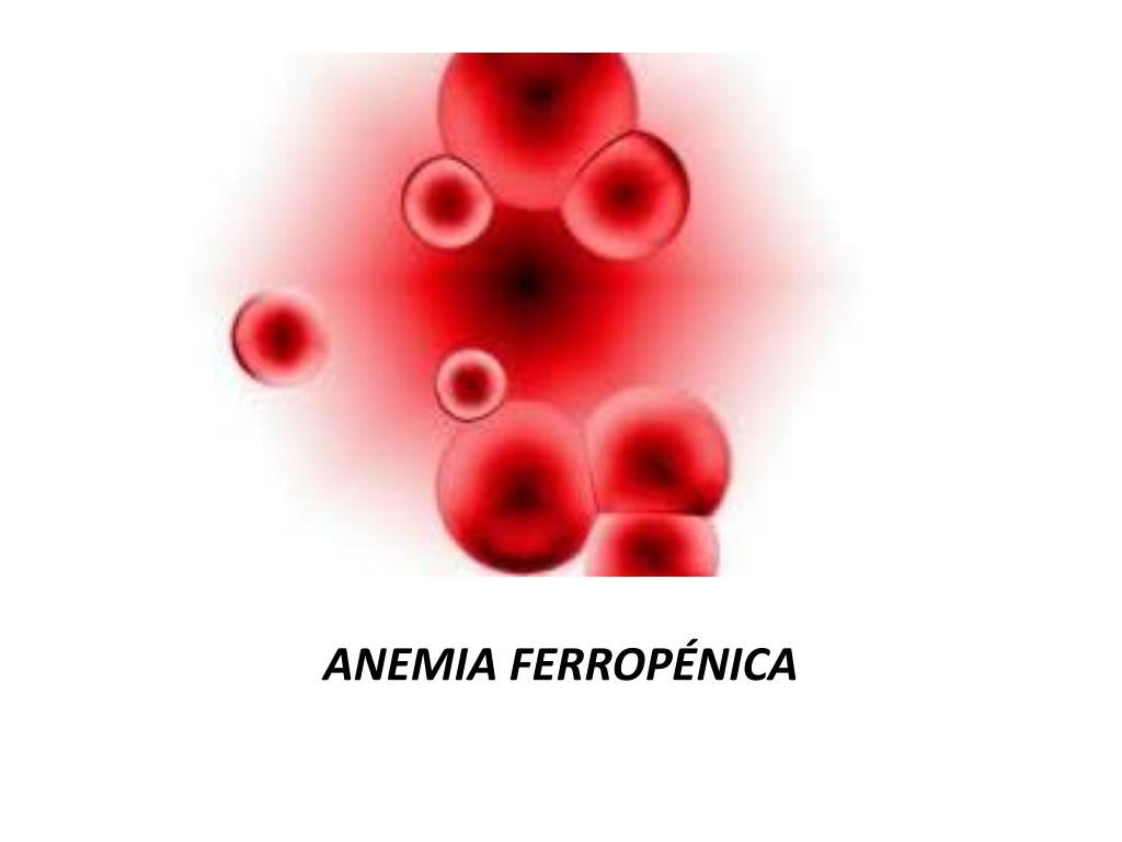 Dieta para anemia ferropenica