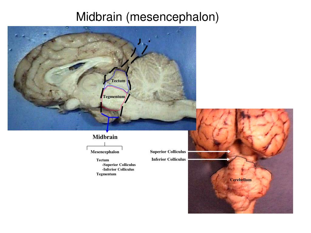 Ppt Sheep Brain Dissection Powerpoint Presentation Free